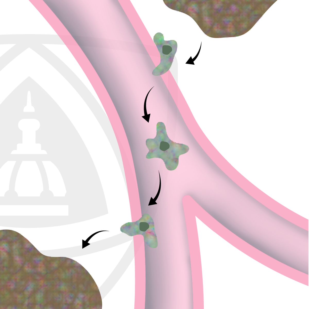 درک متاستاز سرطان