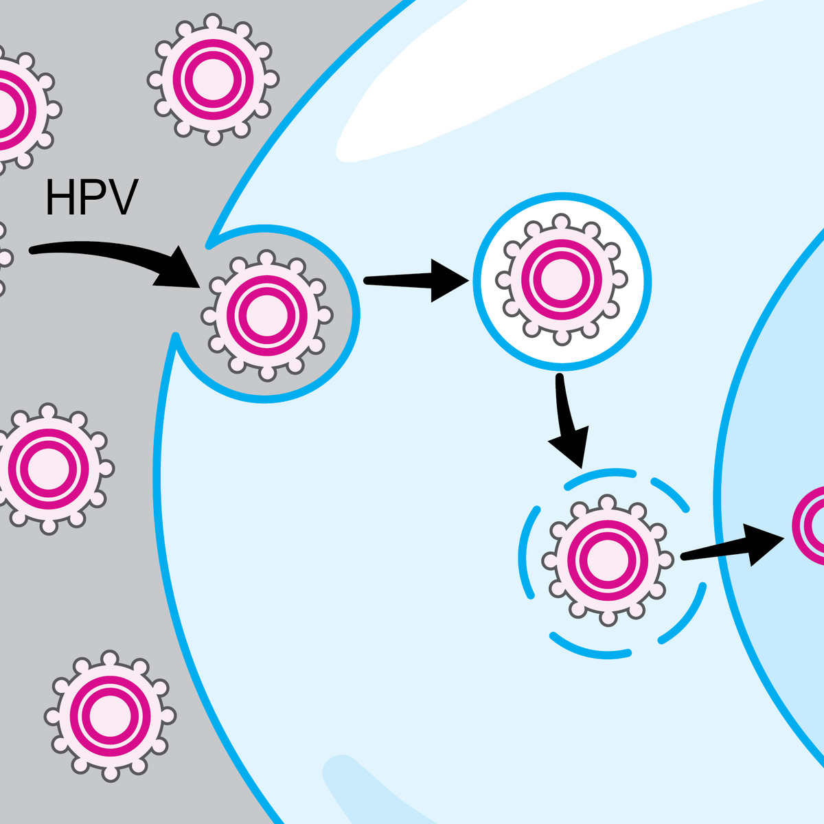 سرطان دهان و گلو مرتبط با HPV: آنچه باید بدانید